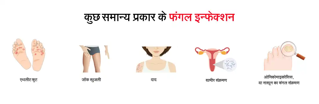 Common types of fungal infection in Hindi